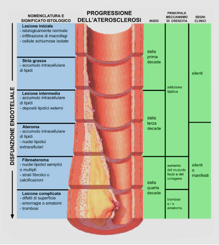 roblog_aterosclerosi